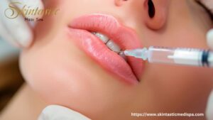 Corteiz la mode qui reflète la réalité 2 Lip Fillers Riverside